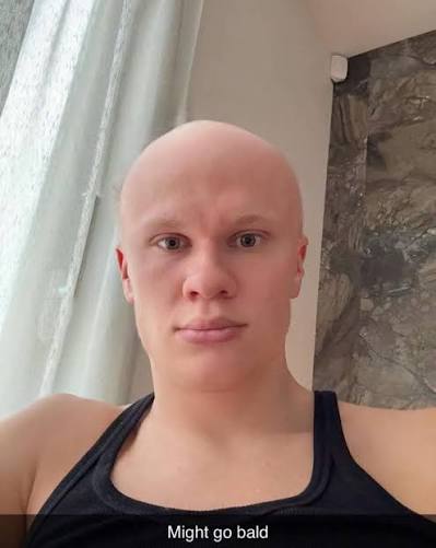 «Могу побриться налысо»